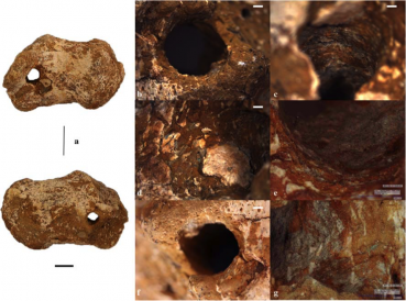 Heel bone from Italy only the second set of physical remains bearing the marks of crucifixion yet discovered